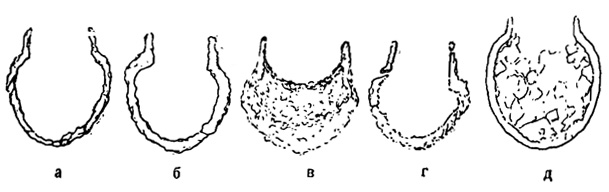 Рис. 2. Calpionella alpina Lorenz: а, б, д - продольные медианные сечения; в, г - тангенциальные сечения. Х 320. Альпийский титон. Швейцария (Deflandre, 1936)