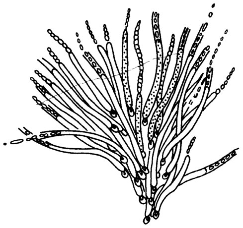 Рис. II. 12. Схематическое изображение современного вида Gloeotrichia pisum (Ag.) Thur. /Определитель..., 1953/